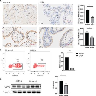 CD39/CD73 Dysregulation of Adenosine Metabolism Increases Decidual Natural Killer Cell Cytotoxicity: Implications in Unexplained Recurrent Spontaneous Abortion